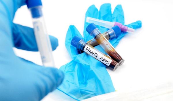 A fost confirmat primul caz de hantavirus în România, la un pacient din Arad. Reacţia INSP