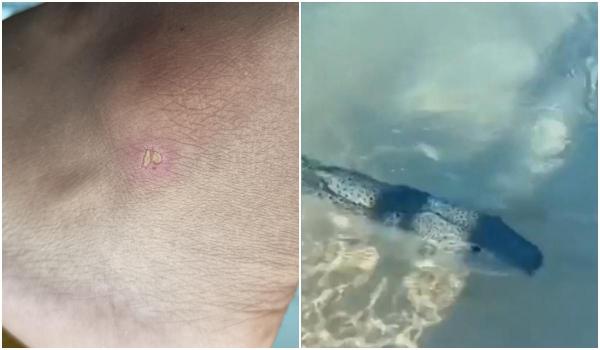 Primul român atacat de peştele-iepure. Turiştii au filmat cum vânează turişti, la mal