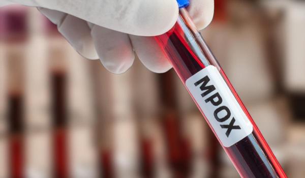 Caz alarmant în SUA. 2 virusologi au încercat să introducă peste 100 de fiole cu virusul mpox în ţară