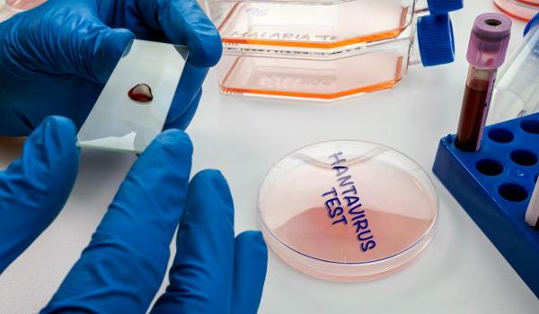 Trei persoane au murit infectate cu hantavirus, în Venezuela. Alte două sunt suspectate