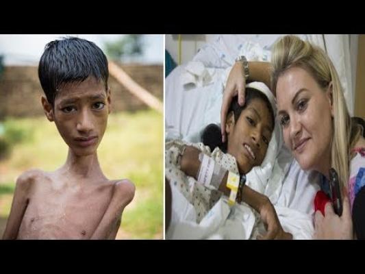 CAZ UNIC în lume: A trăit toată viaţa cu gâtul strâmb, la un unghi de 180 de grade. Acum “este un MIRACOL” ceea ce i se întâmplă (FOTO + VIDEO)