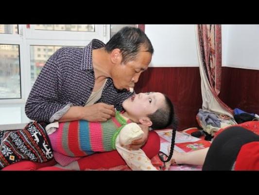 Povestea care te va impresiona până la lacrimi: Părinţii îşi hrănesc copilul din propria gură. Doar aşa rămâne în viaţă (FOTO + VIDEO)