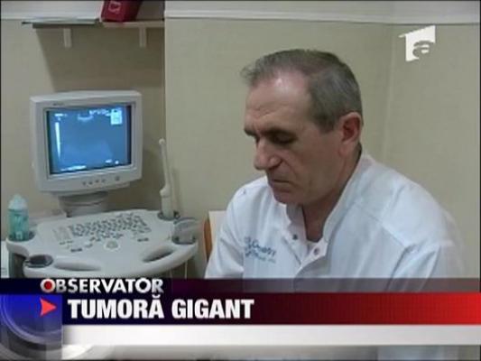 Tumora de 10 kg extirpata la Arad