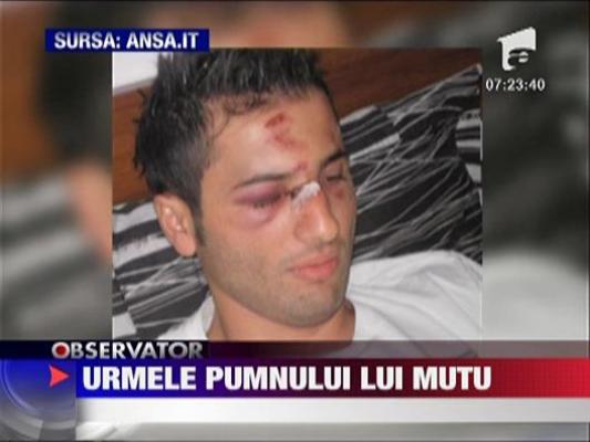 Primele poze cu ospatarul lovit de Adrian Mutu