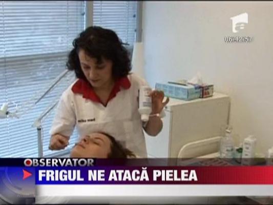 Felicia: Frigul ne ataca pielea