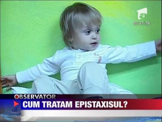 Sanatate: Cum tratam epistaxisul?