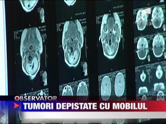 Tumori depistate cu telefonul mobil