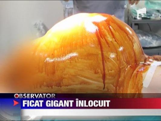 Transplant de Cartea Recordurilor la Spitalul Fundeni