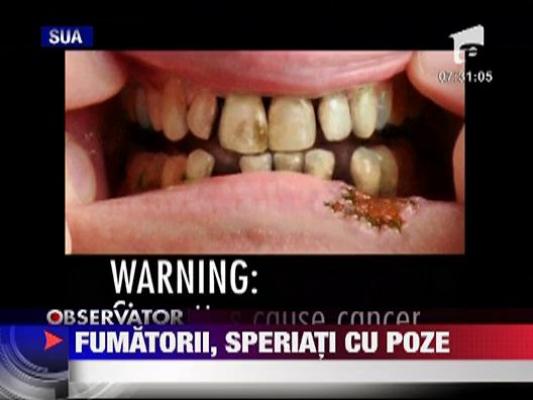 Fumatorii, speriati cu poze
