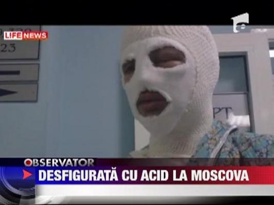 Desfigurata cu acid la Moscova