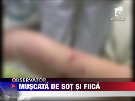 Socant! O femeie de 58 de ani a ajuns in spital dupa ce a fost muscata de sotul si de fiica ei