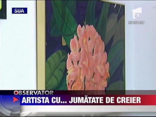 A pierdut jumatate de creier si a devenit artista