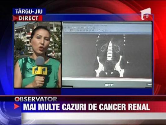 Se inmultesc cazurile de cancer renal