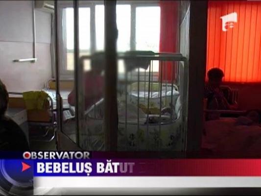 Un bebelus a ajuns la spital cu un ochi vanat, dupa ce a fost lovit de mama sa