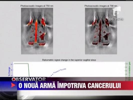 O noua metoda de depistare a cancerului la san