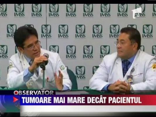 Tumoare mai mare ca pacientul