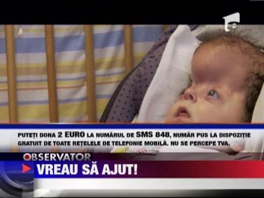 Vreau sa ajut! Vlad a fost diagnosticat cu sindrom Apert