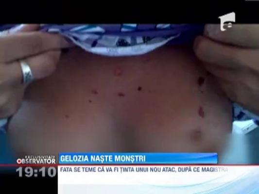 Legea violentei domneste in localitatea unde o adolescenta a fost batuta si arsa cu tigara de o sotie geloasa! Reporterii Observatorului au fost atacati de rude