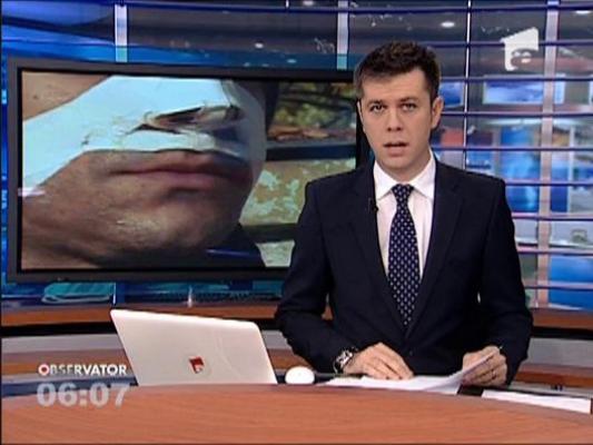 Un tanar ii acuza pe politisti ca l-au desfigurat