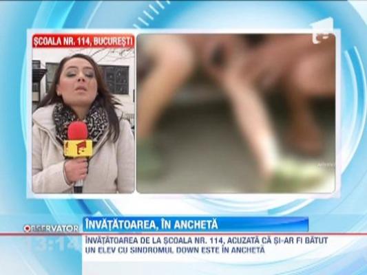 Ancheta in cazul copilului cu sindrom Down maltratat de invatatoarea