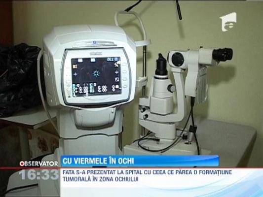 Un vierme de 15 centrimetri a crescut in ochiul unei adolescente