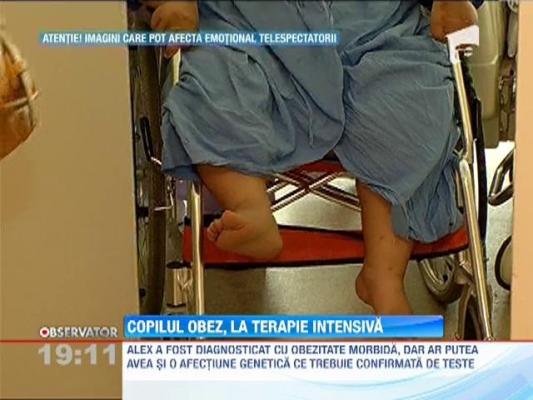 Copilul obez din Craiova, la terapie intensiva