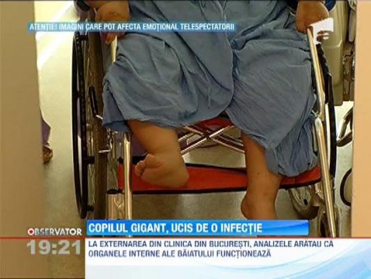 Copilul gigant din Craiova, ucis de pancreatita