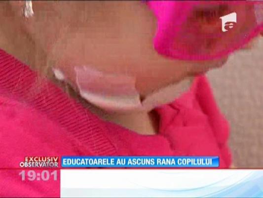 Un copil  s-a tăiat la gât în timp ce se afla la grădiniţă