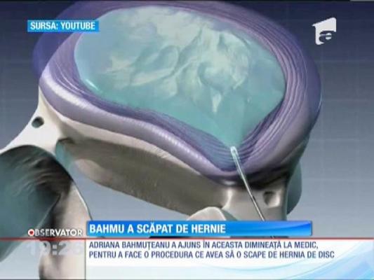 Adriana Bahmuţeanu a scăpat de hernie