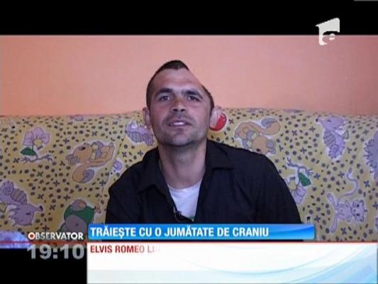Trăieşte cu jumătate de craniu şi e condamnat la suferinţă!