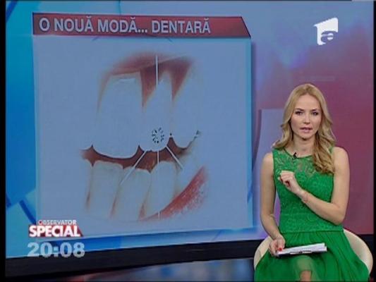 Special! Diamantul, un accesoriu dentar