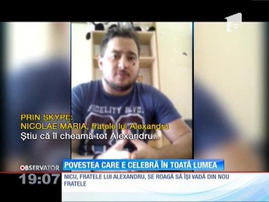 Gemenii despărțiți, subiect pentru presa internațională