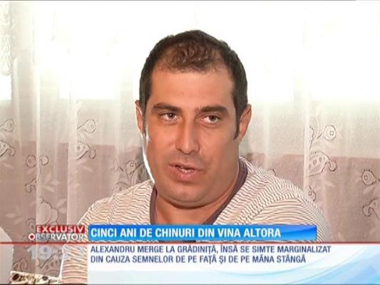 Cinci ani de operaţii chinuitoare pentru copilul uitat în incubator la Maternitatea Bucur