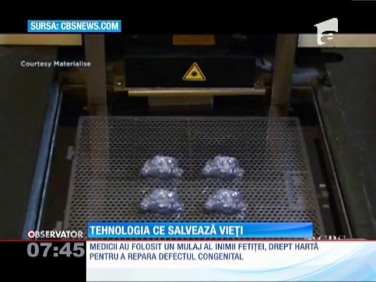 Imprimanta 3D salvează vieți