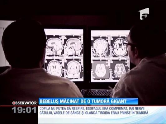 UPDATE! Imagini din timpul operației la care a fost supus un bebeluş, macinat de o tumoră gigant