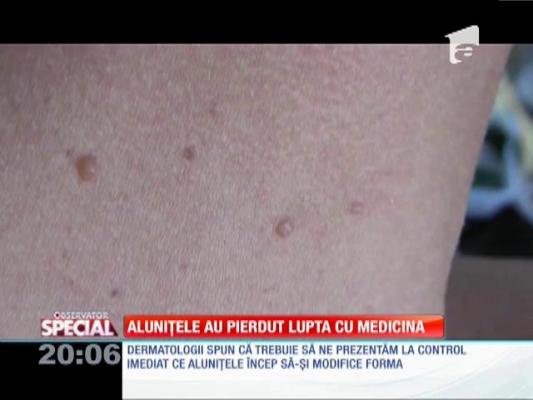 Special! Alunițele au pierdut lupta cu medicina