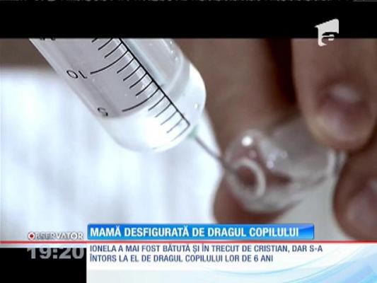 Mamă desfigurată de dragul copilului