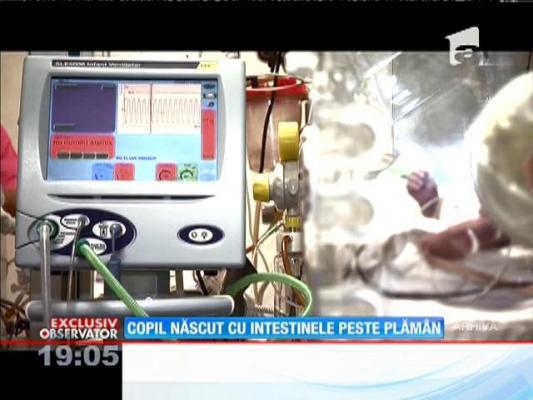 Un copil s-a născut cu intestinele peste plămân. Medicii din Capitală i-au salvat viaţa