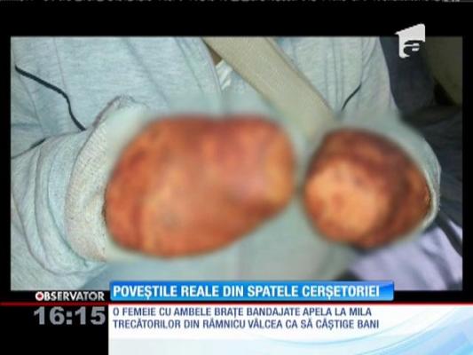 Pentru a primi bani şi-a bandajat ambele mâini ca să dea impresia că sunt tăiate