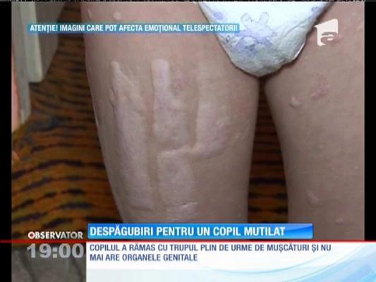 O școală din Timiș va plăti despăgubiri pentru un copil mutilat de câini