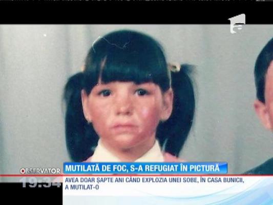 Daniela, o tânără mutilată de foc care s-a refugiat în pictură