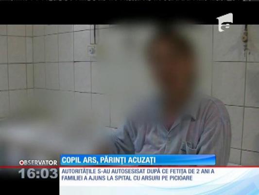 Copil ars după ce a căzut pe o plită încinsă