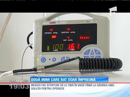 Siamezele născute la Constanţa nu pot fi separate!