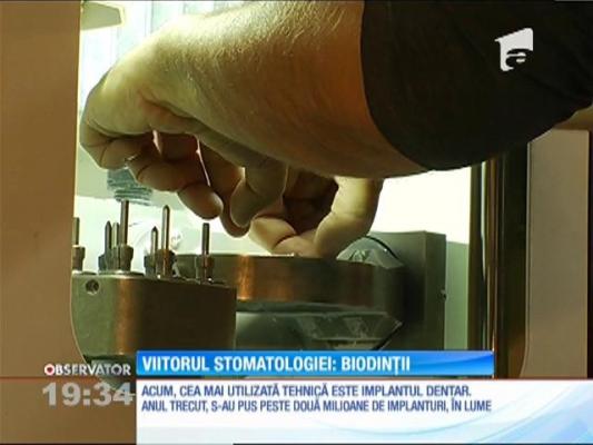 Bio-dinţii sunt viitorul în materie de stomatologie