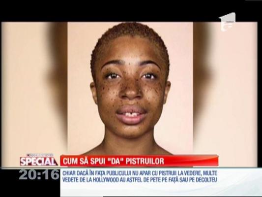 Special! Anul acesta, pistruii sunt la modă! Fie naturali, fie desenaţi