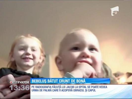 Bebeluș bătut crunt de bonă