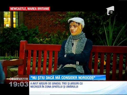 Observator pentru #Colectiv. O dramă ascunsă sub mască. Alex are un trup ca o hartă a durerii: ”Nu știu dacă mă consider norocos!”