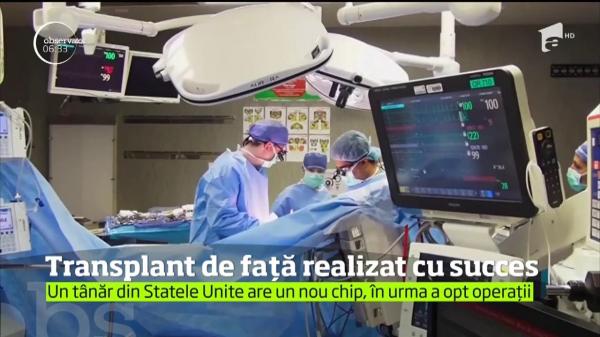 Un bărbat desfigurat şi-a recăpătat chipul! Transplant de faţă realizat cu succes, în SUA