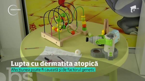 Cum se tratează DERMATITA ATOPICĂ
