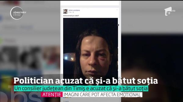 Un consilier judeţean din Timiş, acuzat că şi-a bătut crunt soţia! O fotografie îl incriminează